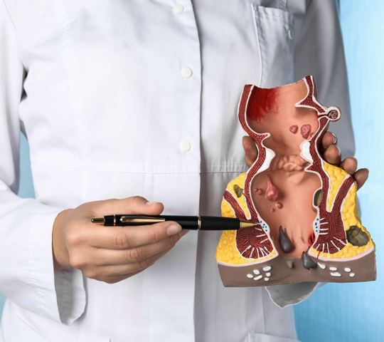 Anal Fissure Laser Treatment