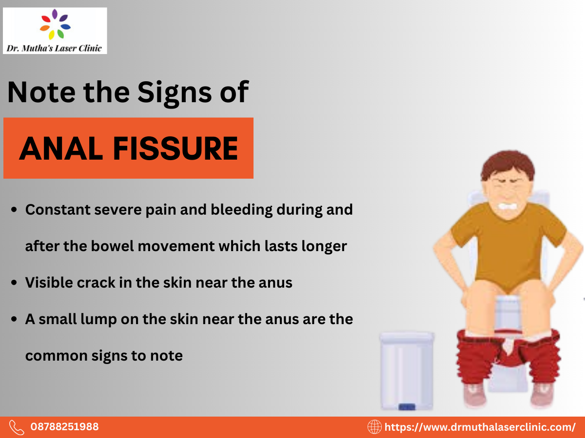 Understanding Anal Fissures: Signs, Symptoms, and Treatment Options -  Insights from Dr. Neha Mutha - Dr. Neha Mutha