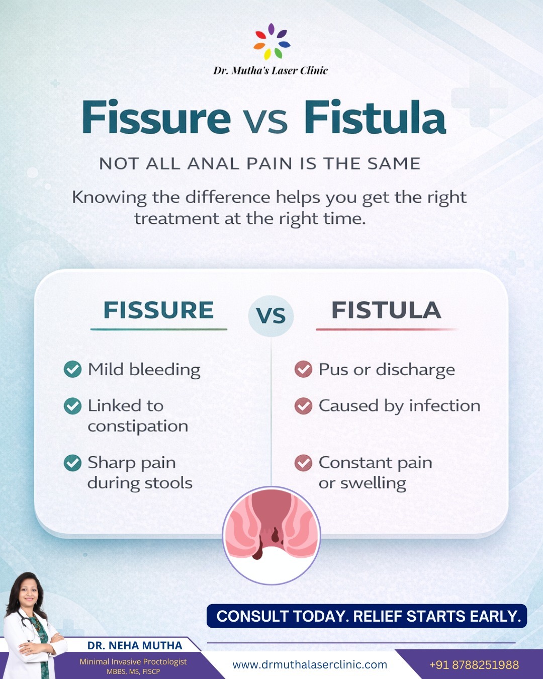 Fissure vs fistula