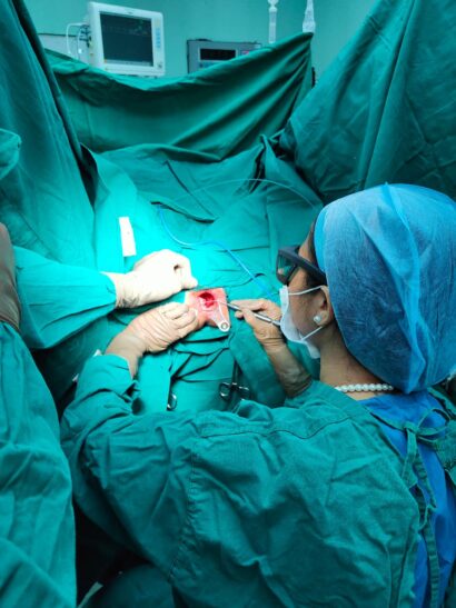 Piles surgery performed by Dr. Neha Mutha, leading Piles Specialist in Pune using advanced laser surgery.