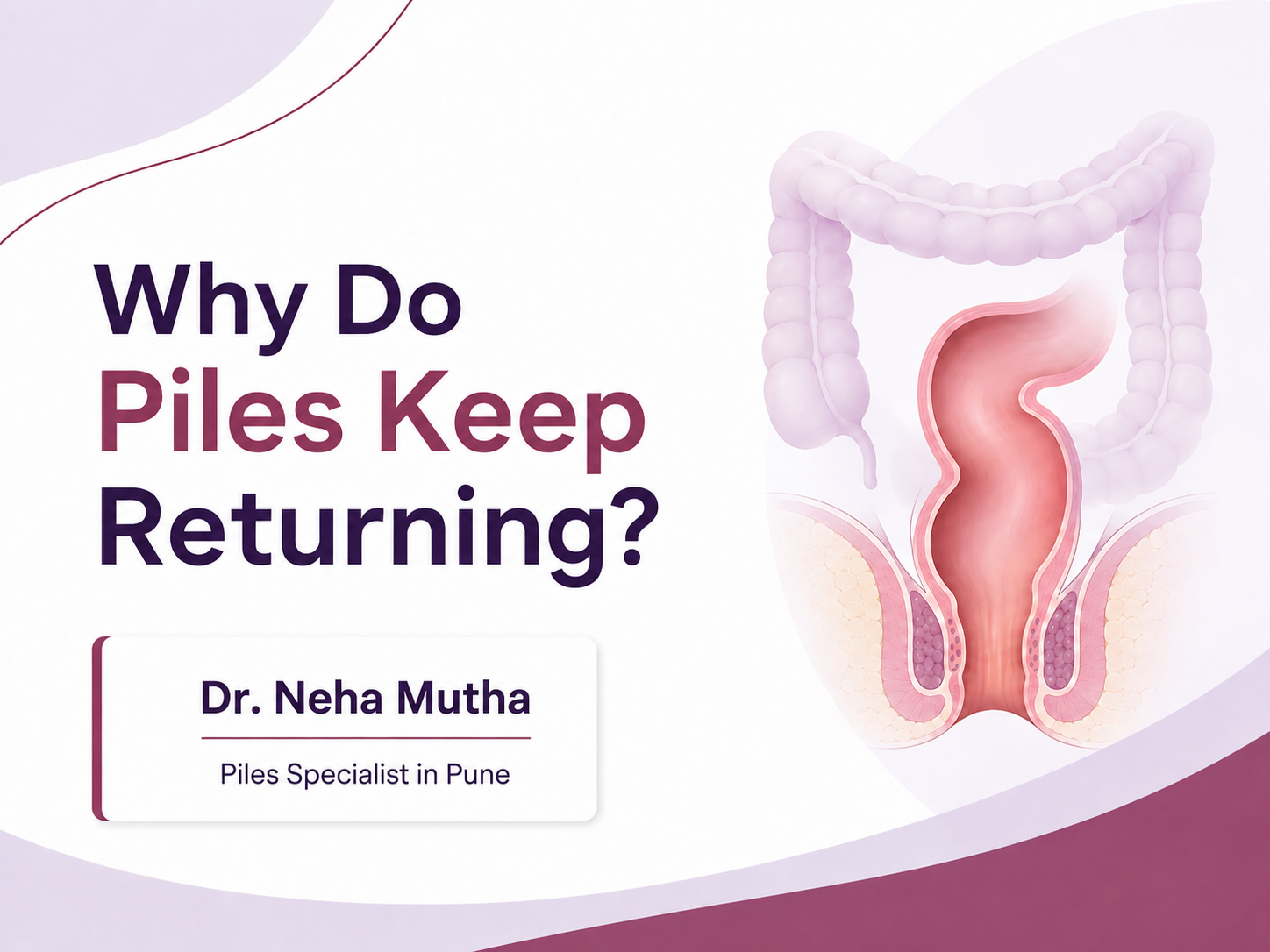 Why do piles keep returning Dr. Neha Mutha explaining the causes and treatment of recurring piles in Pune