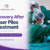 Dr. Neha Mutha explaining recovery after laser piles treatment in Pune