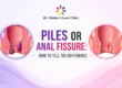 Piles or Anal Fissure: understanding the key differences between common anorectal conditions