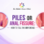 Piles or Anal Fissure: understanding the key differences between common anorectal conditions