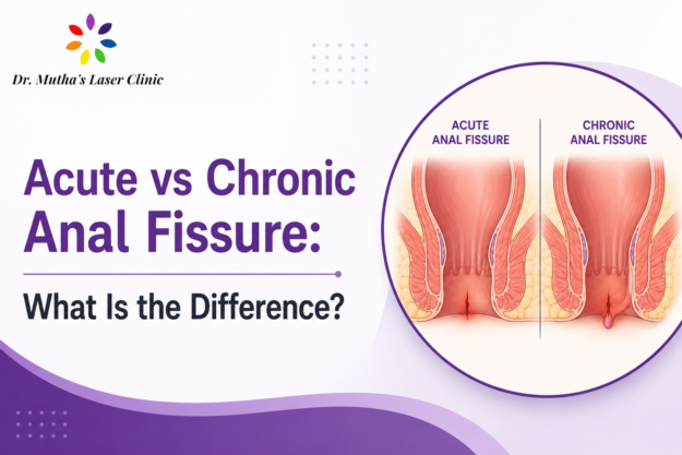 Acute vs chronic anal fissure comparison