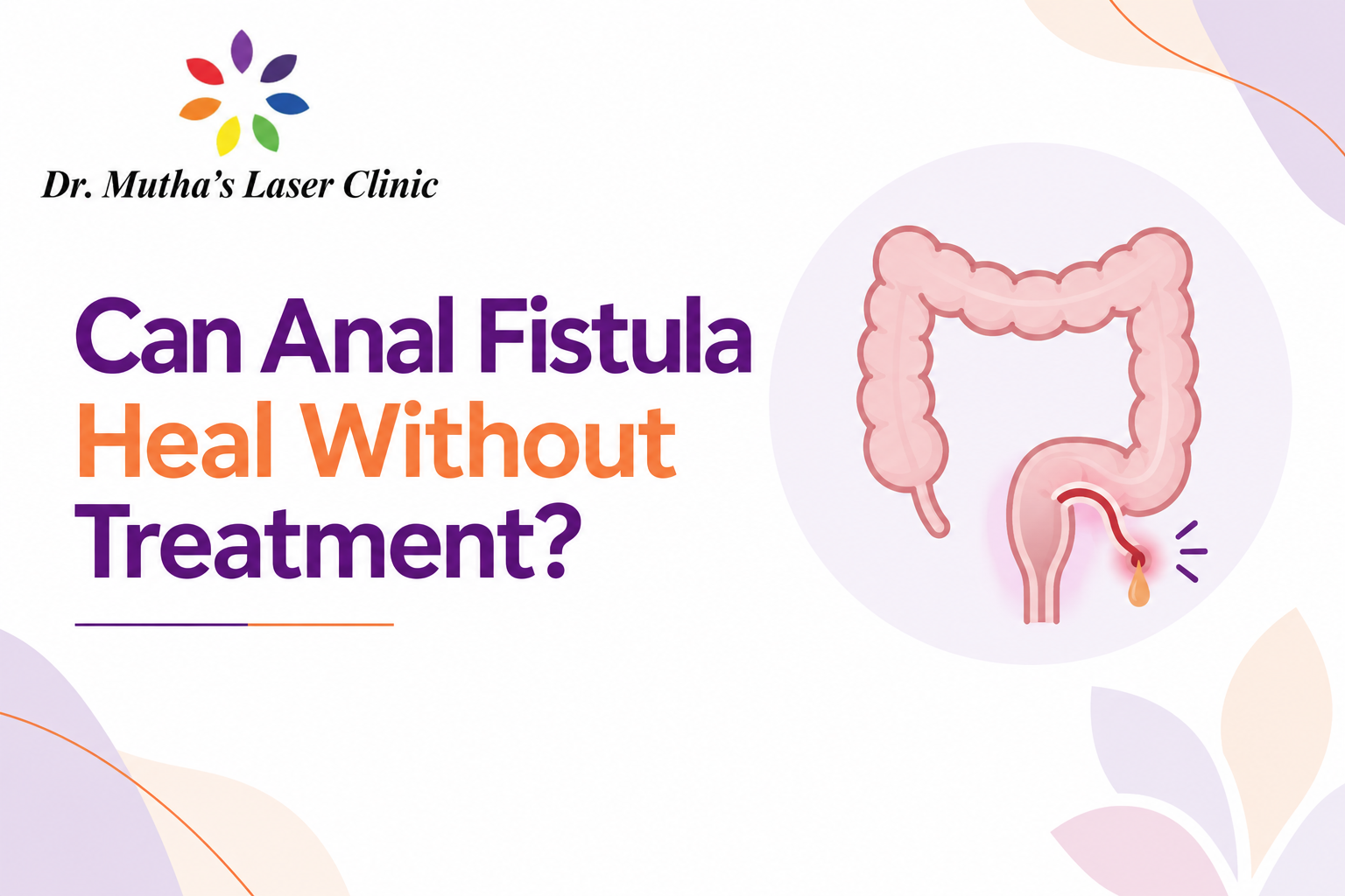 Can Anal Fistula Heal Without Treatment? Anal fistula symptoms and treatment awareness by Dr. Neha Mutha Pune